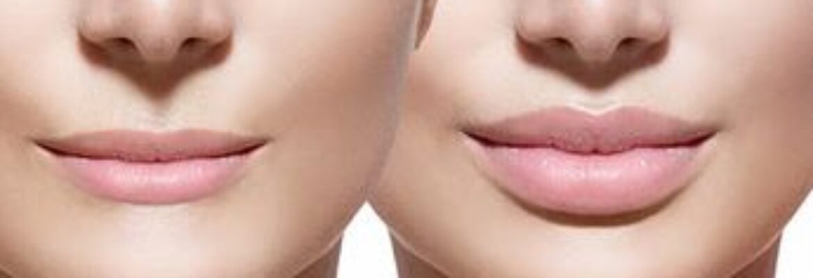 Lip Reduction Surgery Cost in Lagos- Find the Best Surgeons, Reviews and  Book Appointment