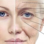 Facial Rejuvenation Surgery Cost in Nairobi