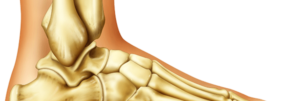 Ankle replacement  Surgery Cost in Lagos – Find the Best Surgeons, Reviews and  Book Appointment