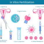 IVF surgery Cost in Lagos