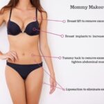 Mommy Makeover Surgery Cost in Nairobi