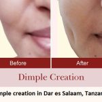 Dimple creation in Dar es Salaam