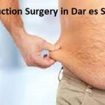 Liposuction Surgery cost in Dar es Salaam