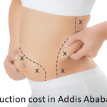 Liposuction cost in Addis Ababa