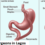 Best Bariatric Surgeons in Lagos