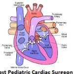 Best Pediatric Cardiac Surgeon