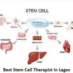 Best Stem Cell Therapist in Lagos