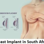 Breast Implant in South Africa