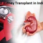 NHIF Kidney Transplant in India