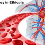 Hematology in Ethiopia