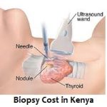 Biopsy Cost in Kenya