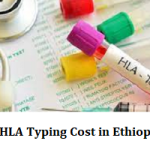 HLA Typing Cost in Ethiopia