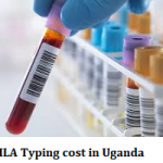 HLA Typing cost in Uganda