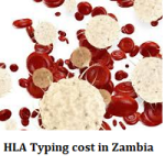 HLA Typing cost in Zambia