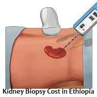 Kidney Biopsy Cost in Ethiopia