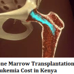 Bone Marrow Transplantation for Leukemia Cost in Kenya
