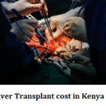 Liver Transplant cost in Kenya