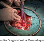 Cardiac Surgery Cost in Mozambique