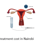 IUI Treatment cost in Nairobi