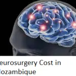 Neurosurgery Cost in Mozambique