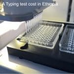 HLA Typing test cost in Ethiopia