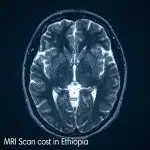 MRI Scan cost in Ethiopia