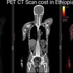 PET CT Scan cost in Ethiopia