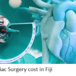 Cardiac Surgery cost in Fiji