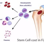 Stem Cell cost in Fiji