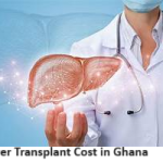 Liver Transplant Cost in Ghana