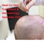 Heal-Liv Hair Transplant & Dermatology Specialty Clinic