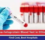 Alpha-Fetoprotein Blood Test in Ethiopia – Find Cost, Best Hospitals