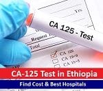 CA-125 Test in Ethiopia – Find Cost & Best Hospitals