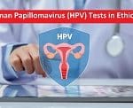 Human Papillomavirus (HPV) Tests in Ethiopia – Find Cost, Best Hospitals