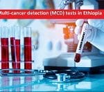 Multi-cancer detection (MCD) tests in Ethiopia – Find Cost, Best Hospitals