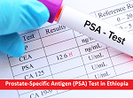 Prostate-Specific Antigen (PSA) Test in Ethiopia