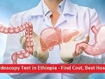 Sigmoidoscopy Test in Ethiopia - Find Cost, Best Hospitals